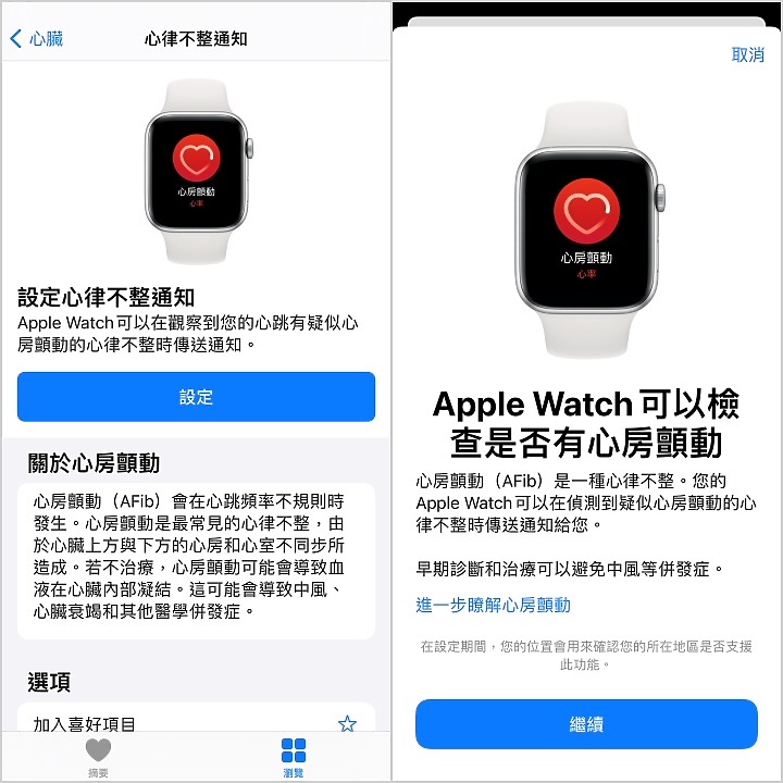 Apple Watch的心電圖ECG功能動手玩 隨手用30秒關心你的小心臟