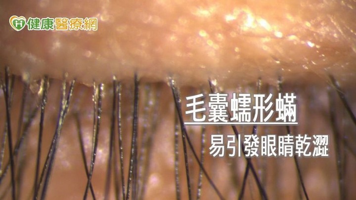 在家防疫兼追劇小心乾眼找上你！