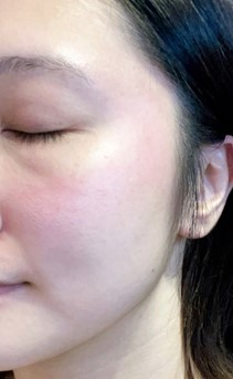 簡單睡前抗痘保養步驟分享