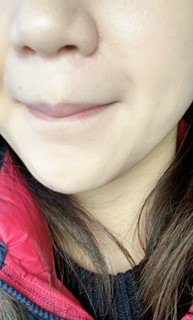 簡單睡前抗痘保養步驟分享