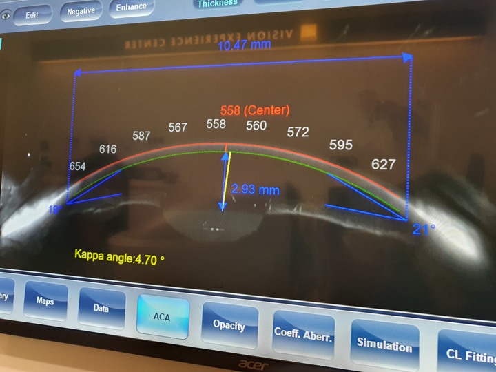 米蘭‧米藍眼鏡精品【東門店】，時尚空間與專業驗光的結合