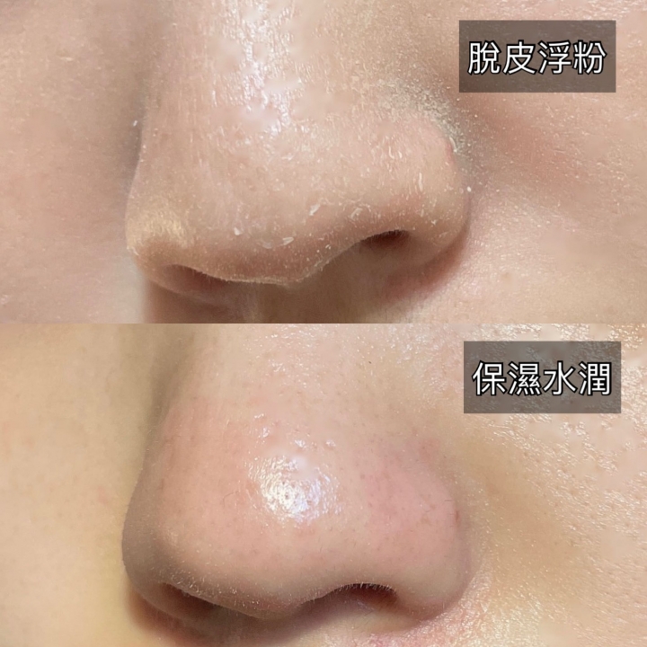 #分享 溫和敏感肌好物Sensist