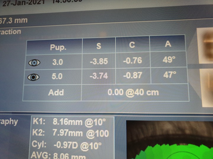 米蘭‧米藍眼鏡精品【東門店】，時尚空間與專業驗光的結合