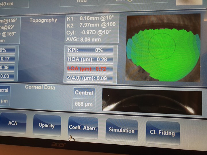 米蘭‧米藍眼鏡精品【東門店】，時尚空間與專業驗光的結合