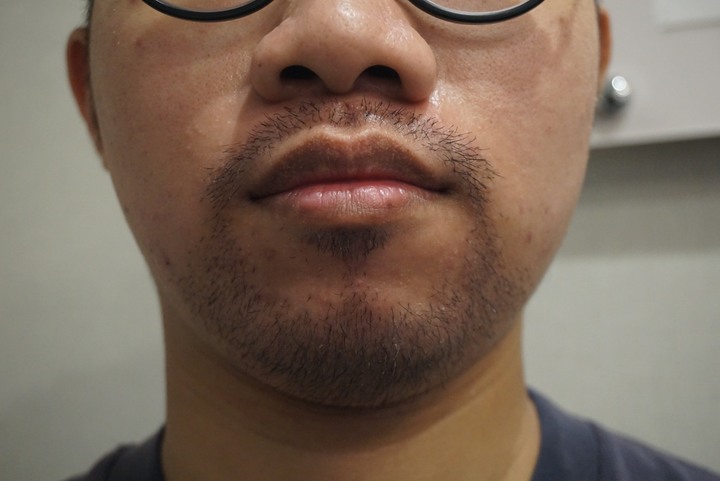 點我看大圖