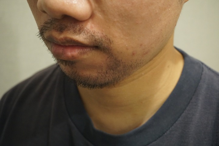 點我看大圖