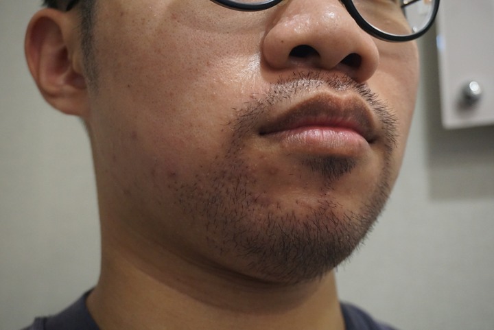 點我看大圖