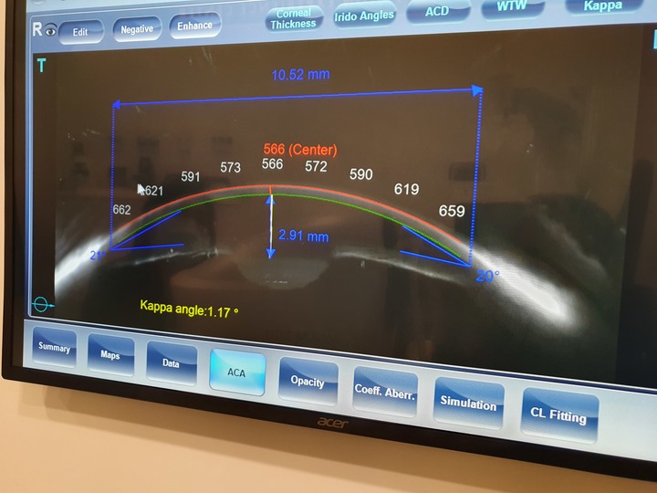 米蘭‧米藍眼鏡精品【東門店】，時尚空間與專業驗光的結合