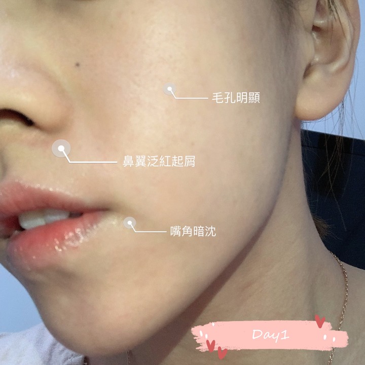分享我的抗老精華液新寵-森美肌