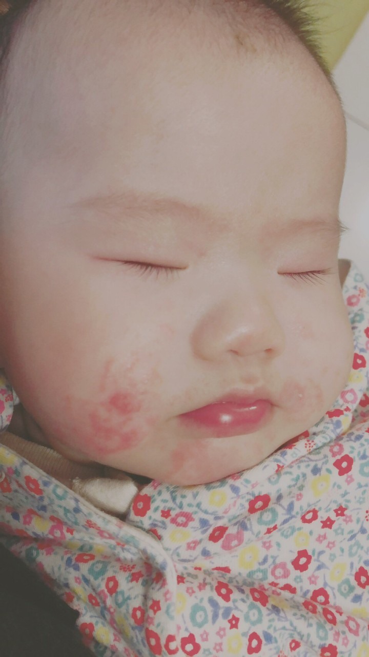 水解奶的小孩真的養不胖?目前喝親舒水解