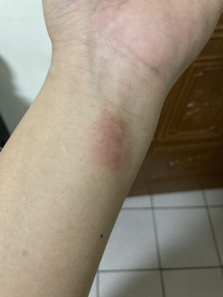 這是錶帶圓形金屬部分造成的嗎？