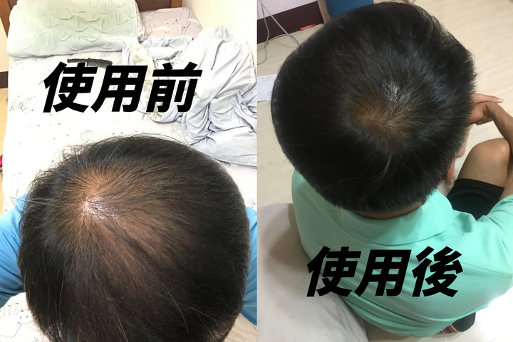 點我看大圖 去年疫情剛爆發 開始戴irestore的簡單分享