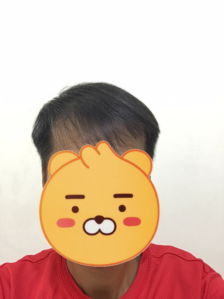 點我看大圖 去年疫情剛爆發 開始戴irestore的簡單分享