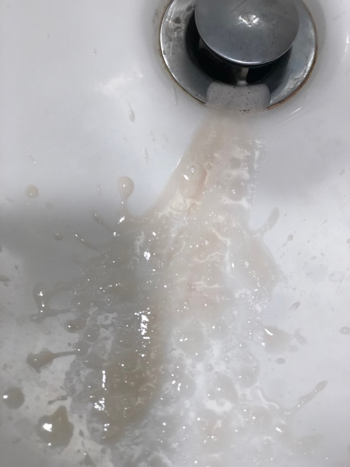 對抗牙周病心路歷程