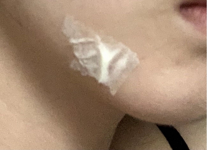 改善口罩痘痘有感的方法