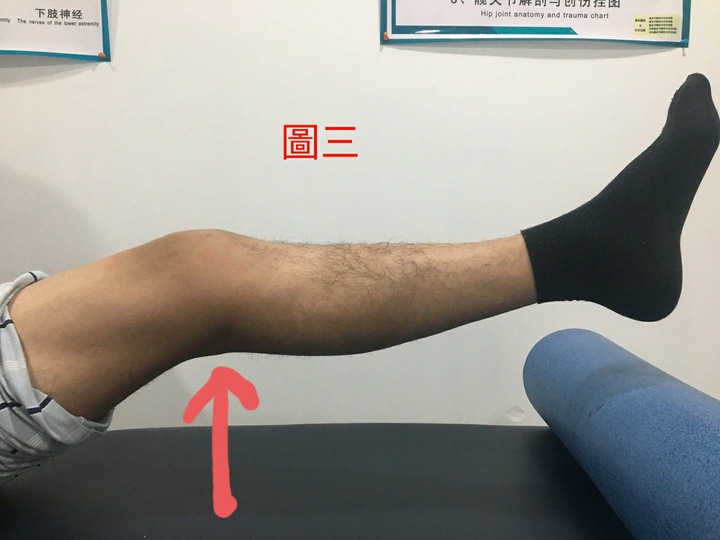 知識文 下坡跑步後膝後僵硬腫脹