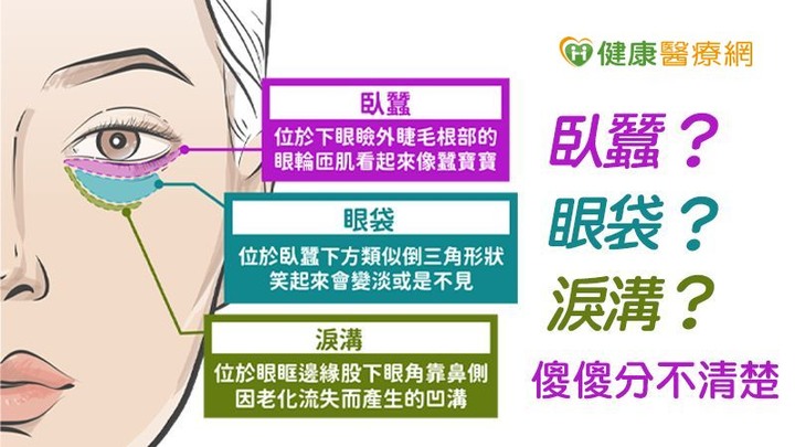 眼袋顯老無神怎麼救？複合式眼袋手術隱密上工