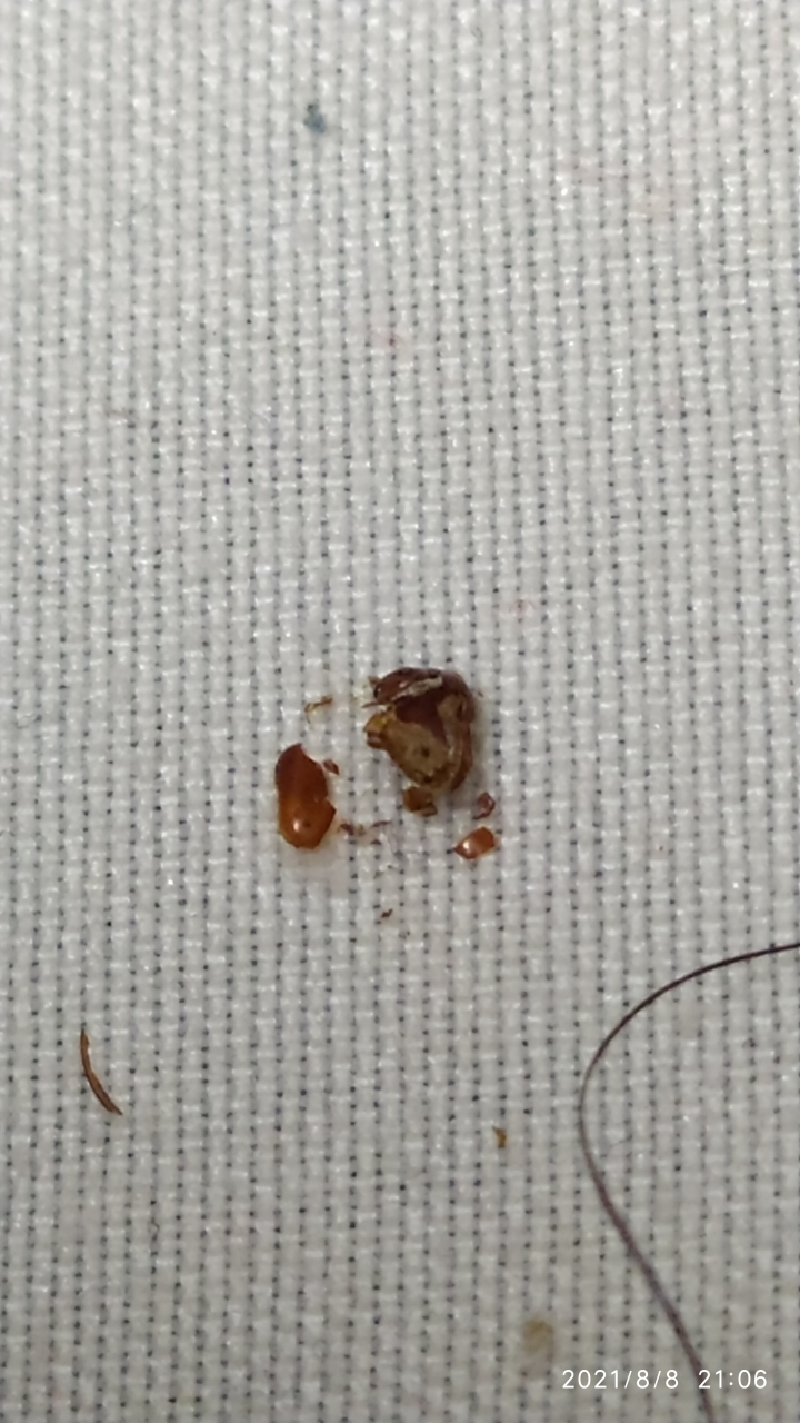 請問這是什麼蟲，似乎會咬人