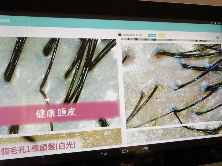 毛爵植髮+頭皮清潔檢測