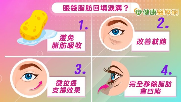 眼袋顯老無神怎麼救？複合式眼袋手術隱密上工