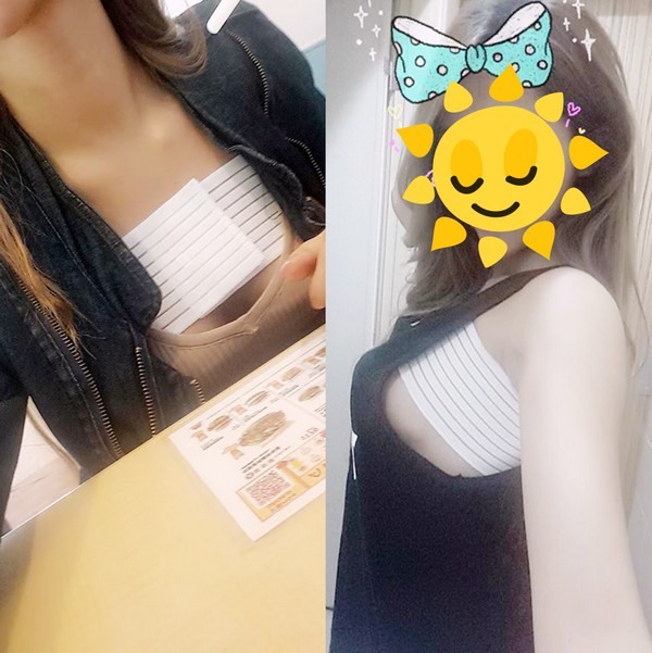 台中隆乳的經驗分享