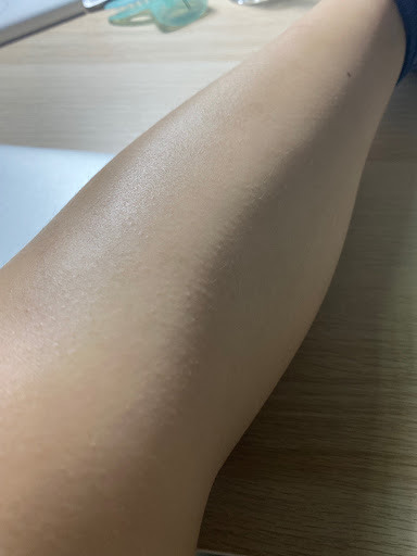 點我看大圖 我用過最有用的除毛方式