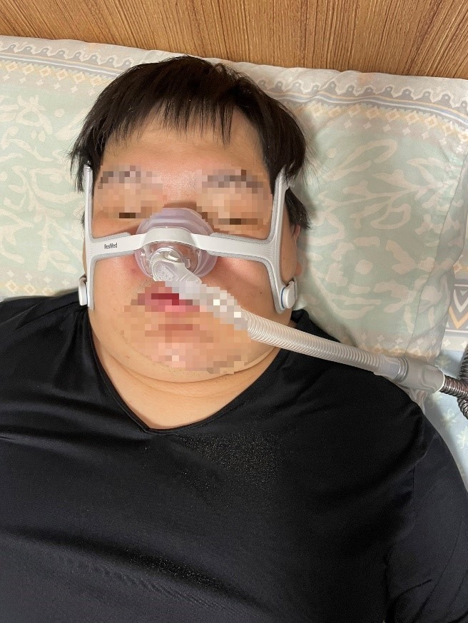 夫妻拯救機使用resmed airsense10呼吸器心得