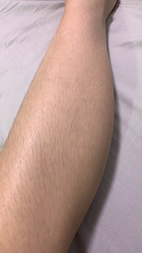 點我看大圖 我用過最有用的除毛方式