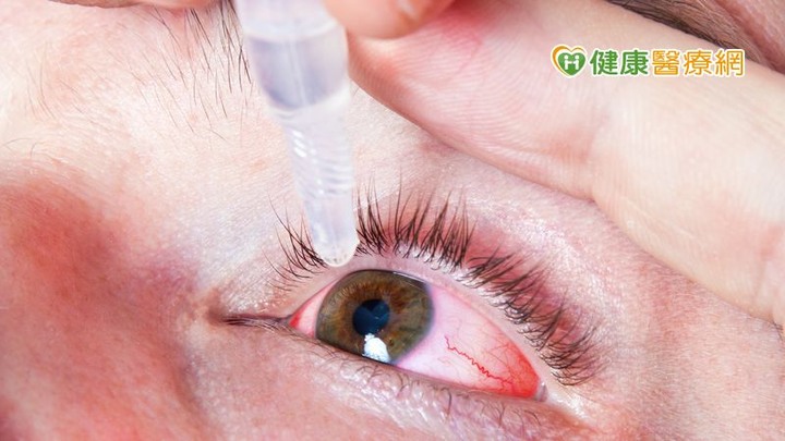 點我看大圖 換季皮膚乾、眼睛糊眼科醫教你護眼拒當乾眼糊矇族