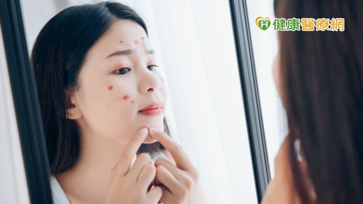 從痘痘看健康戰痘妙招大公開