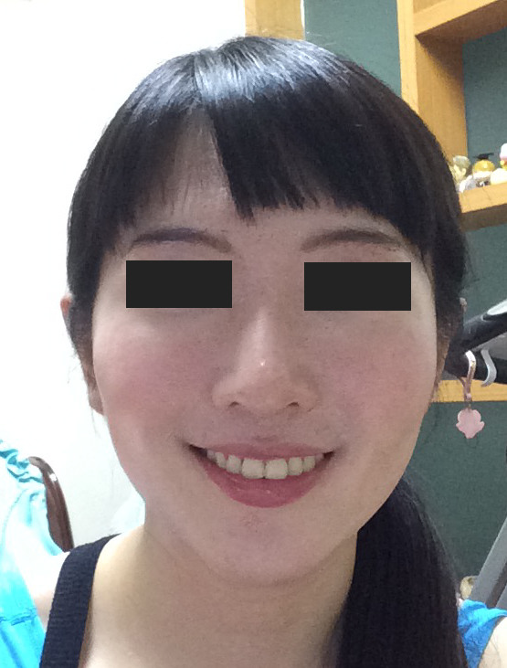 請問這要怎麼修圖?