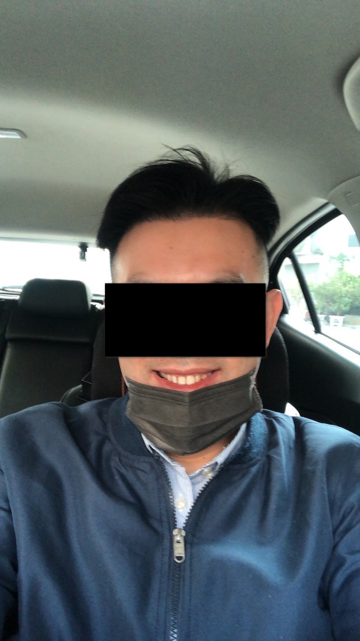 個人微創無痕植髮小記錄+心得