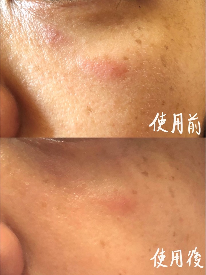 分享我的換季過敏保養品