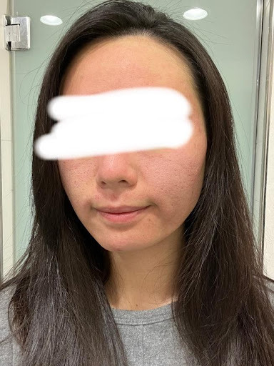 皮秒心得分享