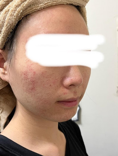 皮秒心得分享