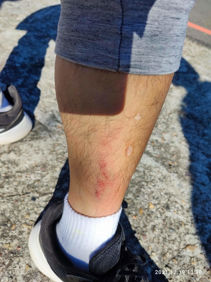 苗栗南庄老街靠右直行被左轉車撞車禍受傷