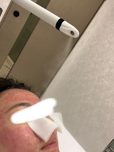 皮秒心得分享