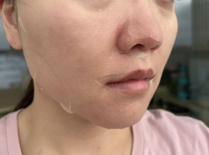 吃A酸後用的簡單保養品