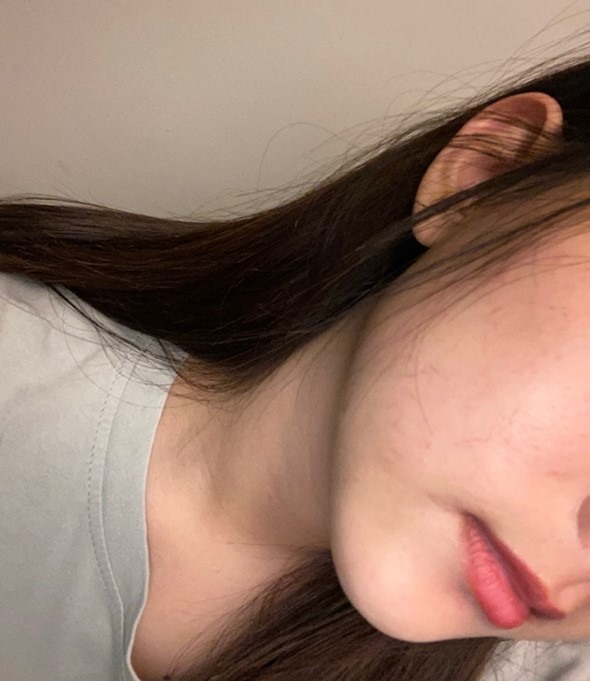 21歲差點成為糖尿病患者…