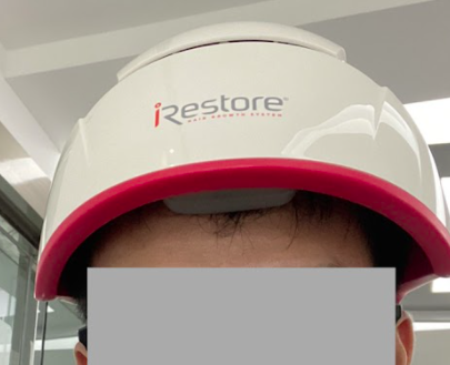 【台北】irestore生髮帽│威麥克總公司│首購評價分享