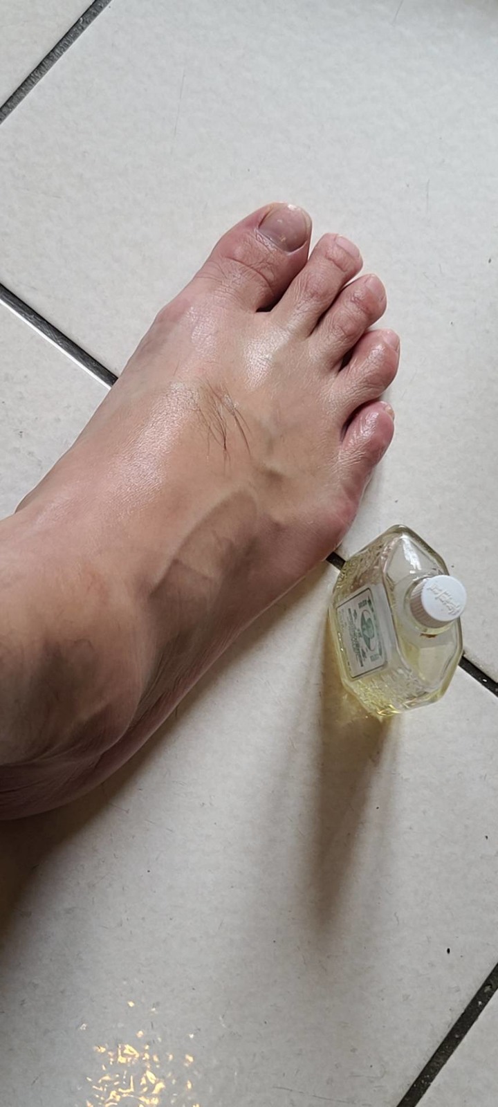 勾勾牌腳痛到不行…來分享的
