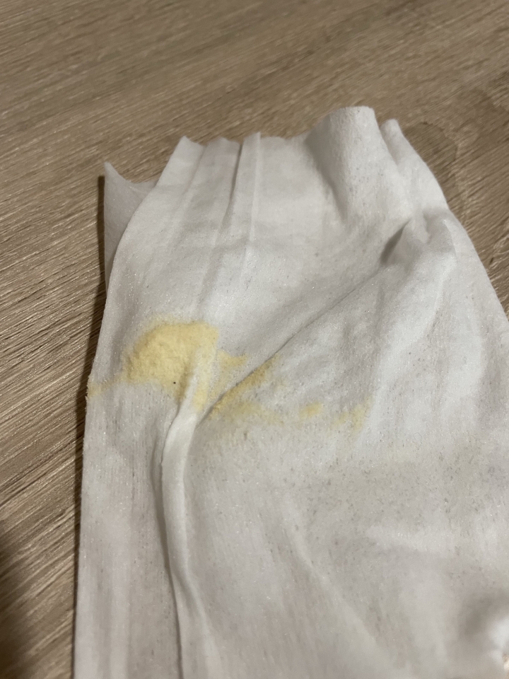 想請問這個是什麼有害嗎（內有圖）
