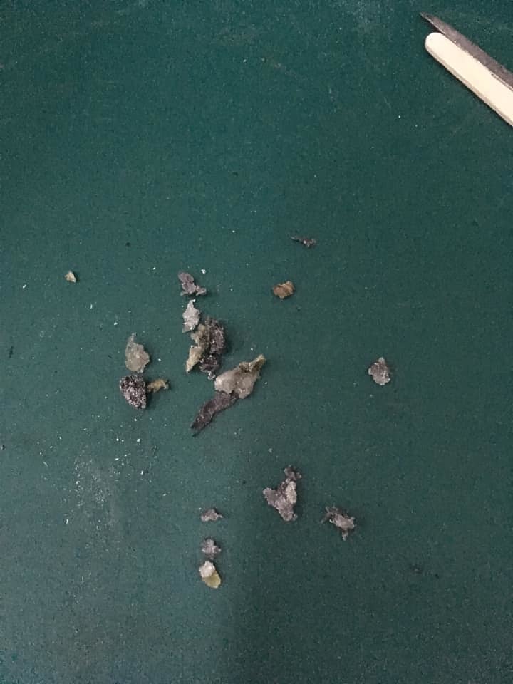TCR座管加長 搶救