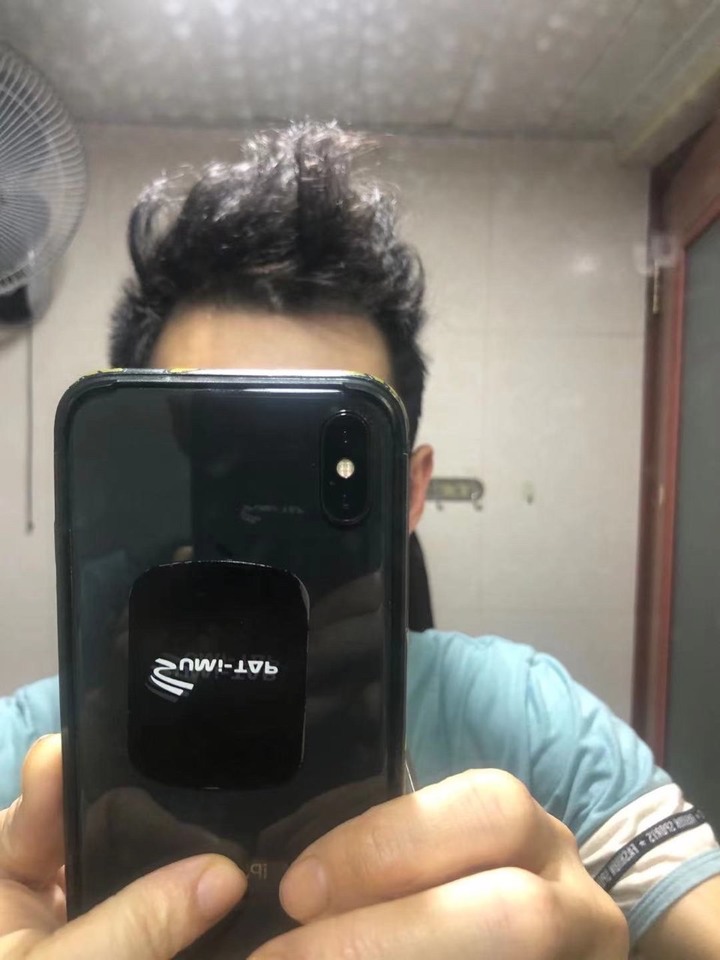i-Hair植髮心得