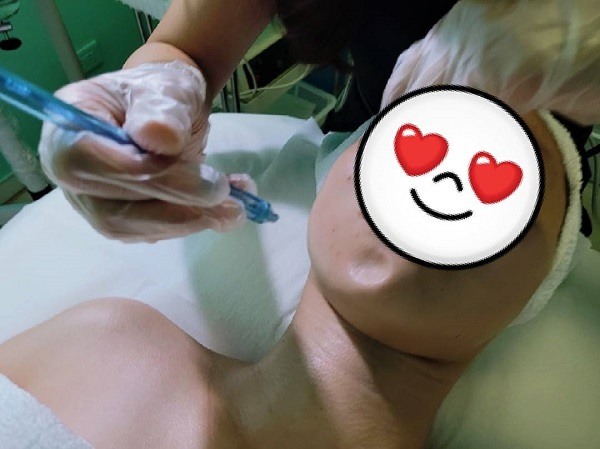 半價水光標靶 不專業開箱分享!!