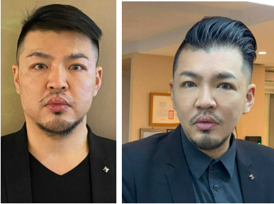 提美拉線雕初體驗 個人覺得拉提效果很好
