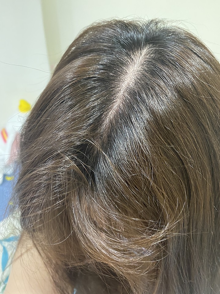 告別油膩膩 開心又美麗 — Alpecin Scalp care 專業頭皮護理系列