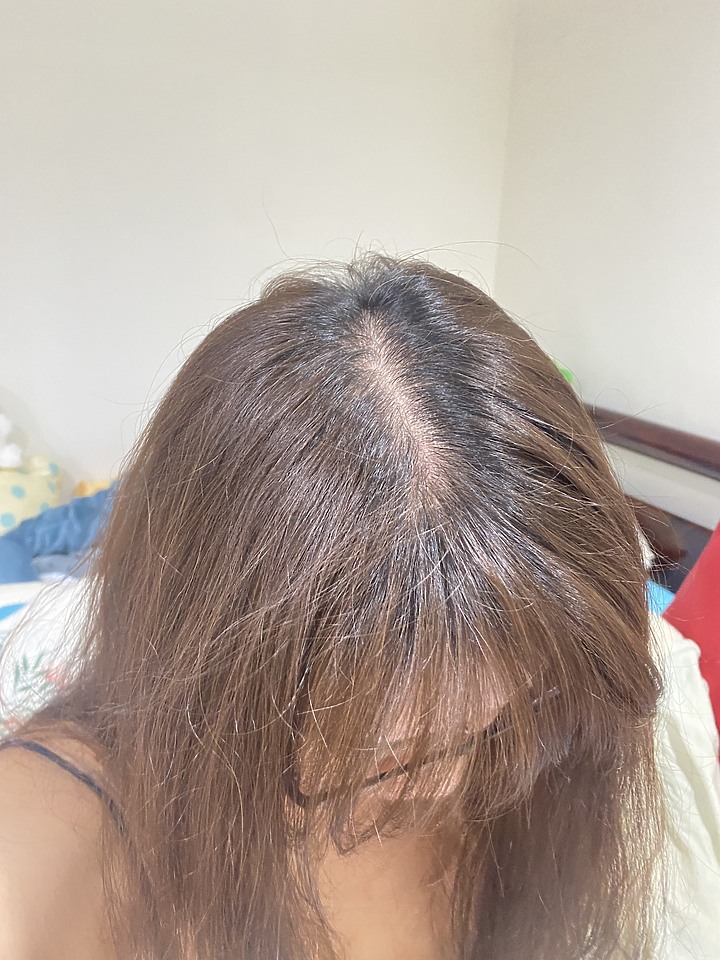 告別油膩膩 開心又美麗 — Alpecin Scalp care 專業頭皮護理系列
