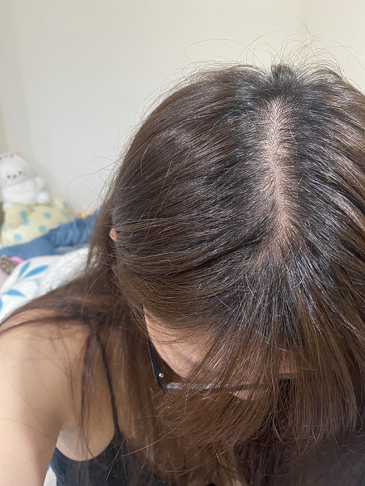 告別油膩膩 開心又美麗 — Alpecin Scalp care 專業頭皮護理系列
