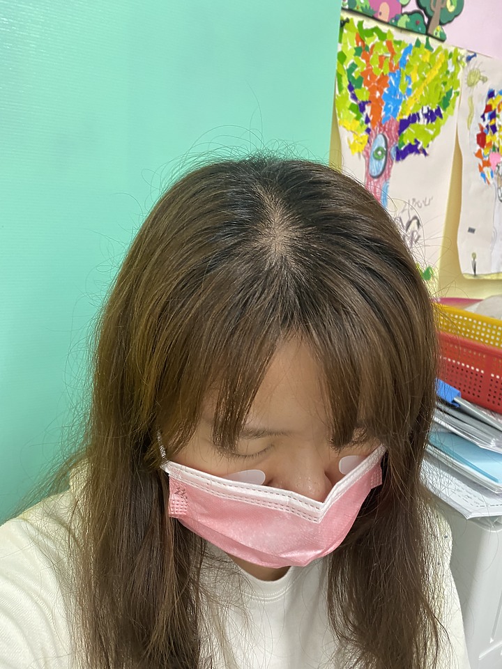 告別油膩膩 開心又美麗 — Alpecin Scalp care 專業頭皮護理系列